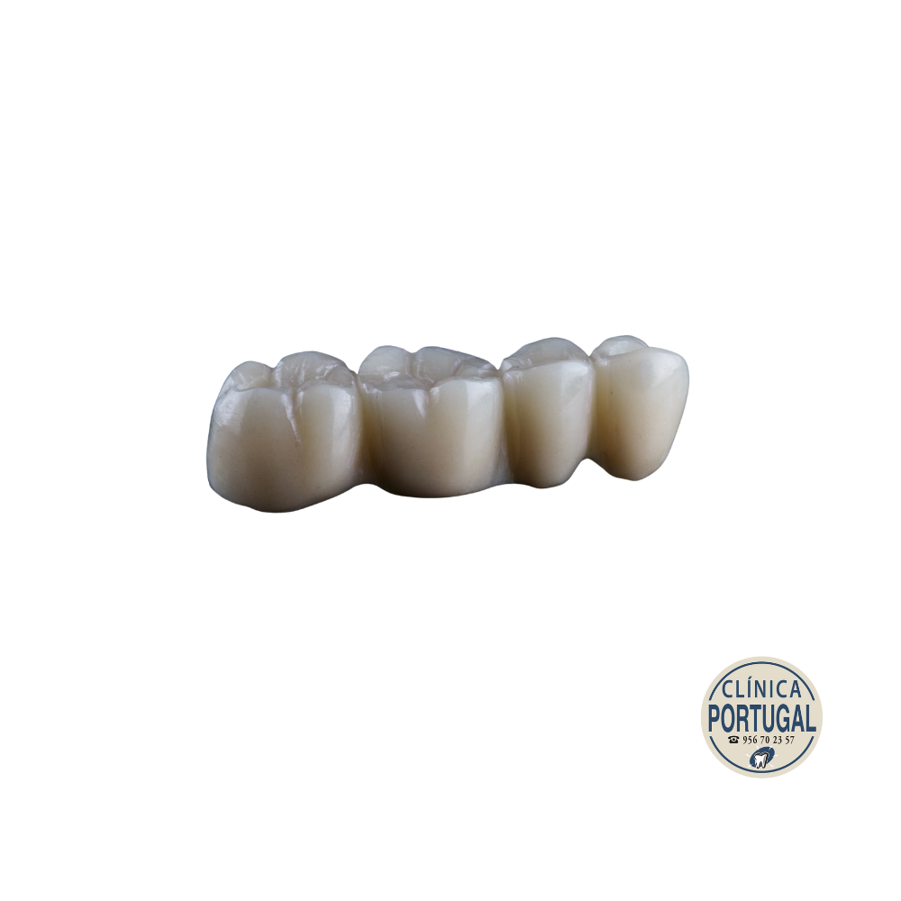 Coronas de zirconio